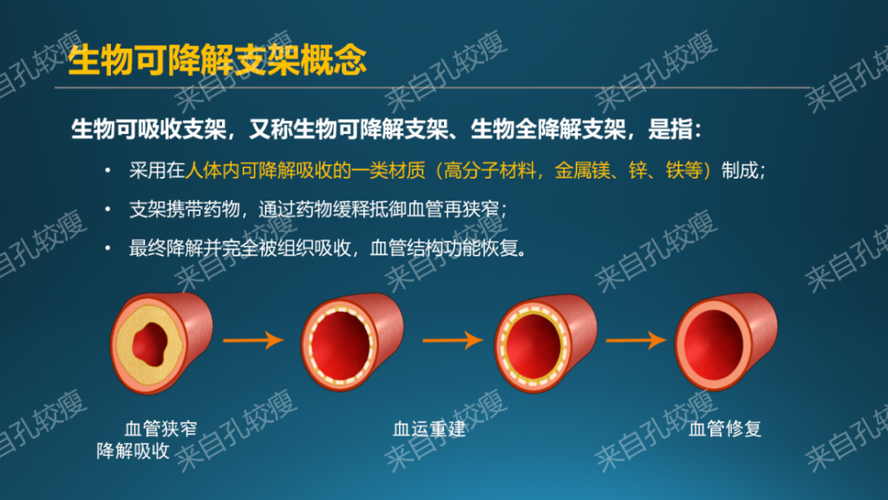 可降解支架-可降解支架为什么叫停